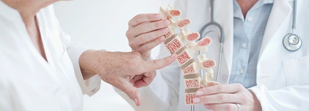 Orthopedic surgeon explains osteopenia and osteoporosis to a patient using a medical model of a spine