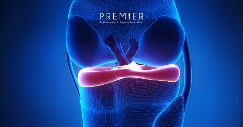 Medical illustration of a knee shows the meniscus and how it can be replaced to restore function at Premier Orthopaedic & Trauma Specialists in California